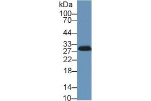 Western Blot; Sample: Porcine Adrenal gland lysate; Primary Ab: 1µg/ml Rabbit Anti-Human STAR Antibody Second Ab: 0. (STAR antibody  (AA 1-285))