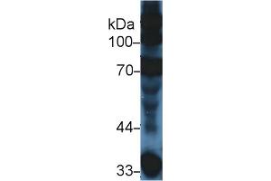 Western Blot; Sample: Mouse Serum; Primary Ab: 5µg/ml Rabbit Anti-Mouse C3a Antibody Second Ab: 0. (C3a antibody  (AA 671-748))