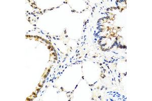 Immunohistochemistry of paraffin-embedded rat lung using IL13 antibody at dilution of 1:100 (40x lens).