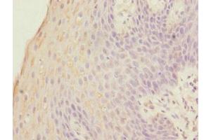 Immunohistochemistry of paraffin-embedded human tonsil tissue using ABIN7153088 at dilution of 1:100 (FOXP1 antibody  (AA 1-114))