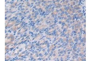 #VALUE! (LRG1 antibody  (AA 136-342))