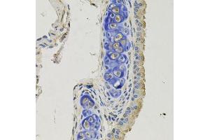 Immunohistochemistry of paraffin-embedded mouse lung using GPHN antibody. (Gephyrin antibody  (AA 520-769))