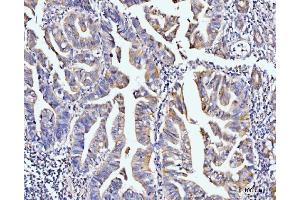 anti-PDZ and LIM Domain 7 (Enigma) (PDLIM7) (AA 275-457) antibody
