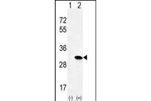 Western blot analysis of HRAS (arrow) using rabbit polyclonal HRAS Antibody (C-term) (ABIN655622 and ABIN2845102).