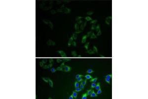 Immunofluorescence analysis of HeLa cells using AK1 Polyclonal Antibody (Adenylate Kinase 1 antibody)