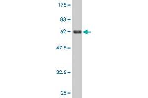 Western Blot detection against Immunogen (63. (BDH1 antibody  (AA 1-343))