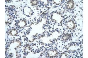 Rabbit Anti-SRBD1 antibody         Paraffin Embedded Tissue:  Human Lung    cell Cellular Data:  alveolar cell    Antibody Concentration:  4. (SRBD1 antibody  (N-Term))