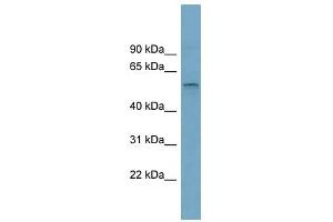 SLC22A15 antibody used at 1 ug/ml to detect target protein. (SLC22A15 antibody  (Middle Region))