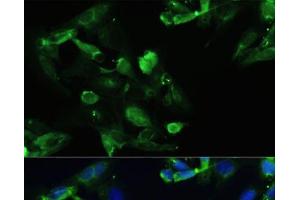 Immunofluorescence analysis of U2OS cells using CXCR5 Polyclonal Antibody at dilution of 1:100. (CXCR5 antibody)