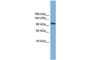WB Suggested Anti-Hira Antibody Titration:  0. (HIRA antibody  (Middle Region))