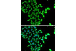 Immunofluorescence analysis of U20S cell using STAM2 antibody. (STAM2 antibody)