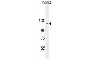 Western Blotting (WB) image for anti-rho GTPase Activating Protein 17 (ARHGAP17) antibody (ABIN2995824)