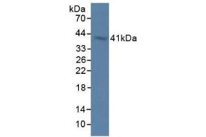 Detection of OAS1 in Rat Stomach Tissue using Polyclonal Antibody to 2',5'-Oligoadenylate Synthetase 1 (OAS1) (OAS1 antibody  (AA 139-358))