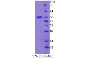 SDS-PAGE analysis of Mouse ROM1 Protein. (ROM1 Protein)