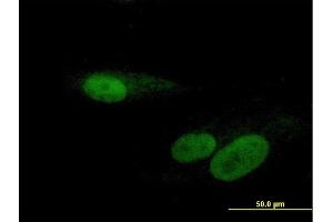 Immunofluorescence of purified MaxPab antibody to RBMY1F on Hs 181. (RBMY1F antibody  (AA 1-496))