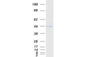 Validation with Western Blot (KLHDC2 Protein (Myc-DYKDDDDK Tag))