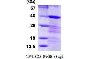 SDS-PAGE (SDS) image for LIM and SH3 Protein 1 (LASP1) (AA 1-261) protein (His tag) (ABIN667659)