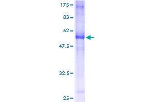 SDS-PAGE (SDS) image for Tumor Necrosis Factor Receptor Superfamily, Member 14 (TNFRSF14) (AA 38-283) protein (GST tag) (ABIN1323163) (HVEM Protein (AA 38-283) (GST tag))