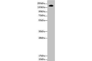 Western blot All lanes: NUP155 antibody at 3. (NUP155 antibody  (AA 1102-1391))