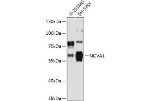 Western blot analysis of extracts of various cell lines, using NOV antibody (2030) at 1:3000 dilution.