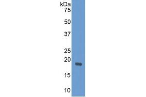 SDS-PAGE of Protein Standard from the Kit (Highly purified E. (Angiopoietin 2 CLIA Kit)