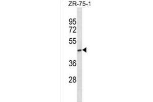 ST6GALNAC5 Antibody (C-term) (ABIN1881843 and ABIN2838433) western blot analysis in ZR-75-1 cell line lysates (35 μg/lane). (ST6GALNAC5 antibody  (C-Term))