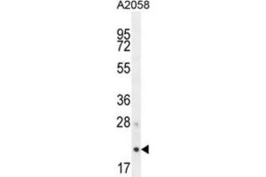 Western Blotting (WB) image for anti-Adaptor-Related Protein Complex 3, sigma 1 Subunit (AP3S1) antibody (ABIN2995675)