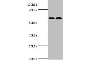 Western blot All lanes: Serine/threonine-protein kinase PAK 2 antibody at 2 μg/mL Lane 1: Jurkat whole cell lysate Lane 2: Hela whole cell lysate Secondary Goat polyclonal to rabbit IgG at 1/10000 dilution Predicted band size: 58 kDa Observed band size: 58 kDa (PAK2 antibody  (AA 1-212))