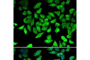 Immunofluorescence analysis of U2OS cells using CCAR2 Polyclonal Antibody