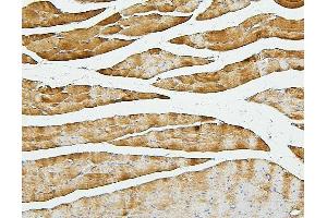 IHC analysis of Cofilin-2 using anti-Cofilin-2 antibody (ABIN7602747). (Cofilin 2 antibody  (C-Term))