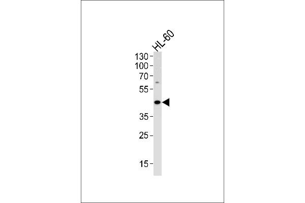 ADA antibody  (C-Term)