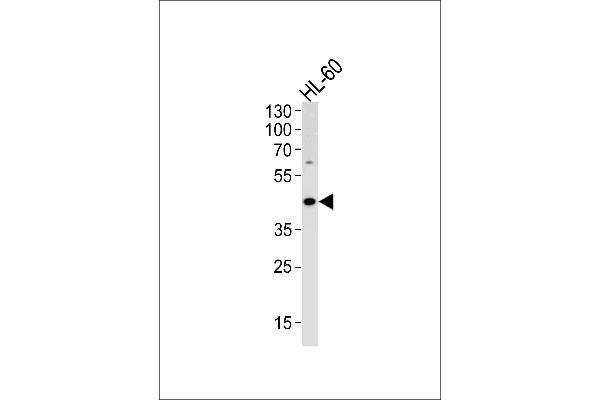 ADA anticorps  (C-Term)