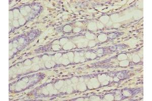 Immunohistochemistry of paraffin-embedded human colon tissue using ABIN7165470 at dilution of 1:100 (FAM222B antibody  (AA 351-562))
