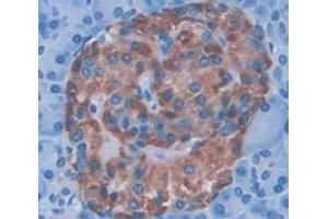 Figure. (CDK16 antibody  (AA 165-446))