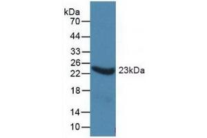 Western Blotting (WB) image for Orosomucoid 1 (ORM1) ELISA Kit (ABIN6574212)