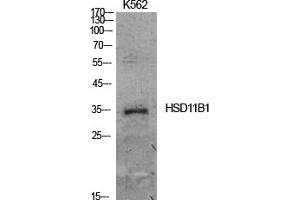 Western Blot analysis of K562 cells using 11β-HSD1 Polyclonal Antibody.