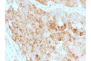 Formalin-fixed, paraffin-embedded human Kidney stained with ROR2 Mouse Monoclonal Antibody (ROR2/1911). (ROR2 antibody)