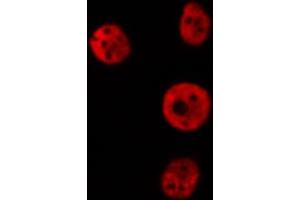 ABIN6274172 staining Hela cells by IF/ICC. (IRF2 antibody  (Internal Region))