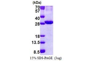 SDS-PAGE (SDS) image for ATPase, Na+/K+ Transporting, beta 2 Polypeptide (ATP1B2) (AA 68-290) protein (His tag) (ABIN5853151) (ATP1B2 Protein (AA 68-290) (His tag))