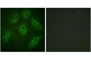 Immunofluorescence analysis of HeLa cells, using MAP4 (Ab-696) Antibody. (MAP4 antibody  (AA 662-711))