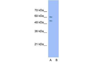 Host:  Rabbit  Target Name:  ARIH2  Sample Type:  Jurkat  Lane A:  Primary Antibody  Lane B:  Primary Antibody + Blocking Peptide  Primary Antibody Concentration:  1. (ARIH2 antibody  (N-Term))