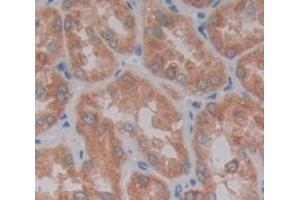 Used in DAB staining on fromalin fixed paraffin- embedded Kidney tissue (TANK antibody  (AA 131-369))