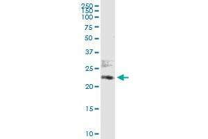 Immunoprecipitation of ATF6 transfected lysate using anti-ATF6 MaxPab rabbit polyclonal antibody and Protein A Magnetic Bead , and immunoblotted with ATF6 purified MaxPab mouse polyclonal antibody (B01P) . (ATF6 antibody  (AA 1-202))