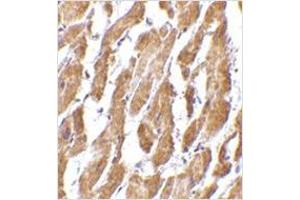 Immunohistochemistry of CRTH2 in human heart tissue with CRTH2 antibody at 2.