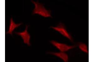 ABIN6267438 staining NIH-3T3 by IF/ICC. (RPS6KB1 antibody  (pSer371))