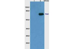 L1 mouse embryo lysates L2 mouse thymus lysates probed with Anti Phospho-Syk (Tyr525/526) Polyclonal Antibody, Unconjugated (ABIN746273) at 1:200 overnight at 4 °C. (SYK antibody  (pTyr525, pTyr526))