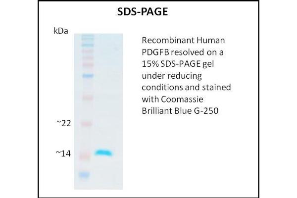 PDGFB Protein