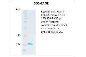 SDS-PAGE (SDS) image for Platelet Derived Growth Factor Subunit B (PDGFB) (Active) protein (ABIN5509325) (PDGFB Protein)