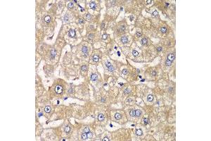 Immunohistochemistry of paraffin-embedded human liver injury using HIP1 antibody at dilution of 1:100 (x40 lens). (HIP1 antibody)