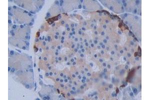 DAB staining on IHC-P; Samples: Rat Pancreas Tissue (METTL21C antibody  (AA 1-248))